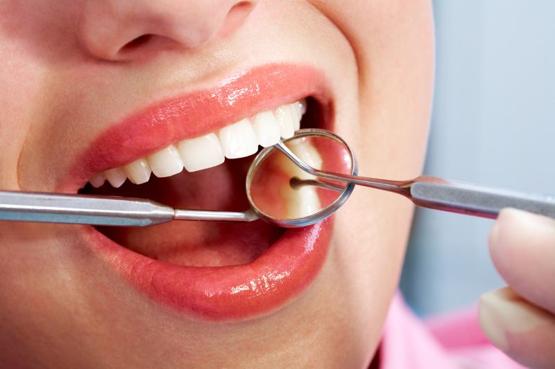 Dejstva o zobnih luskah, ki jih še ne poznate